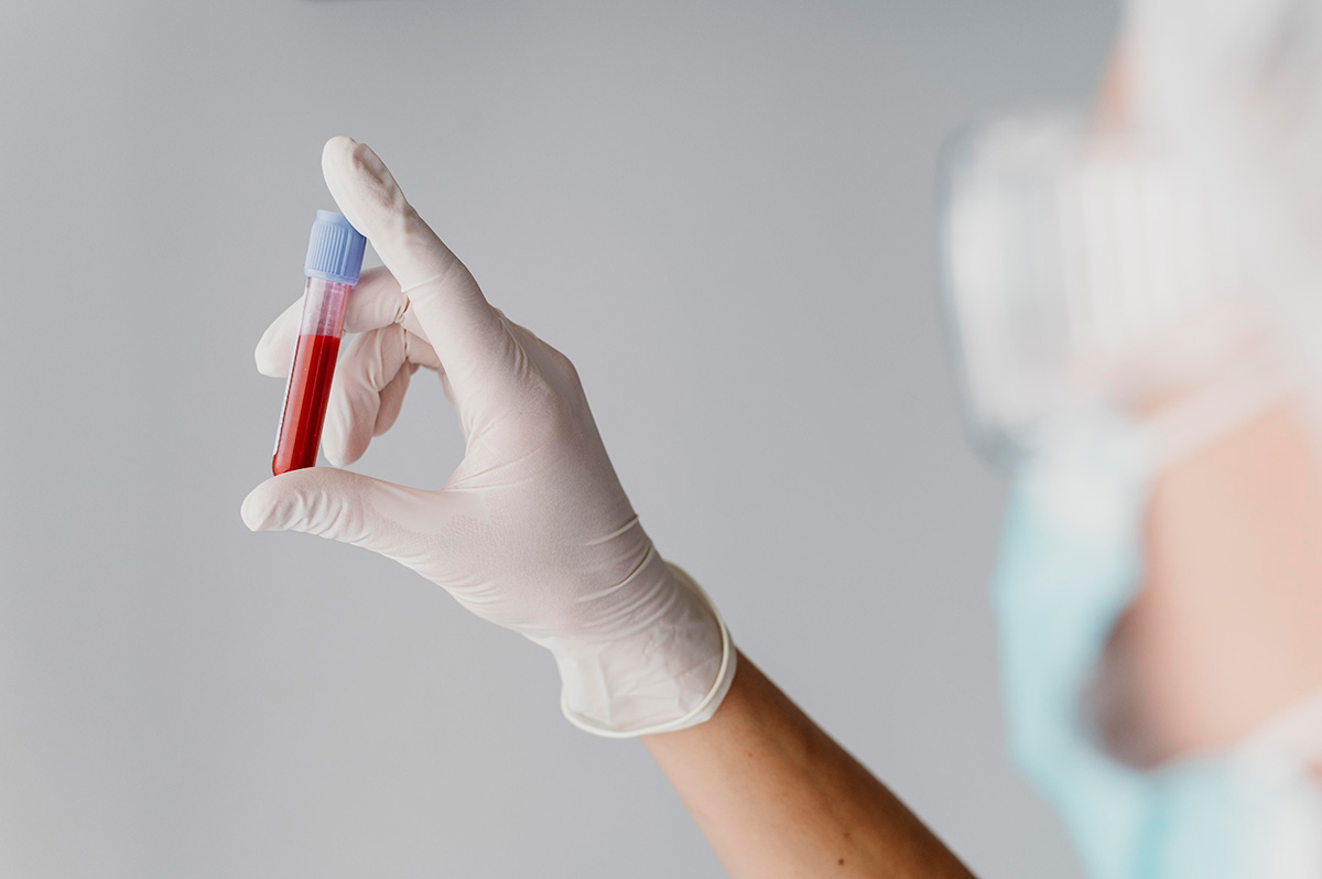 Как правильно сдавать кровь на анализы?